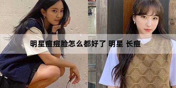 明星痘痘脸怎么都好了 明星 长痘